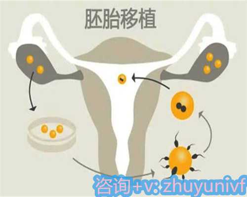 警惕俄罗斯试管婴儿四大常见骗局